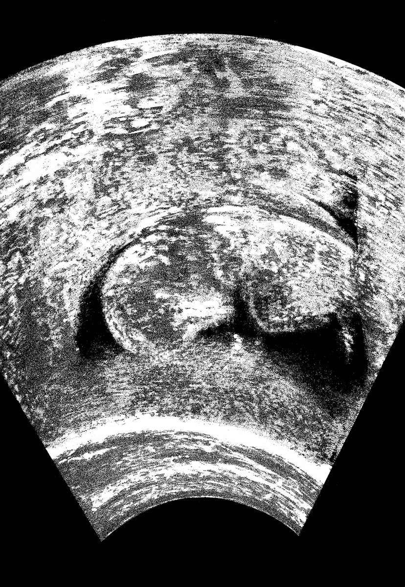 Read Homunculus ES Manga Online